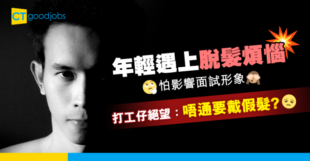 【職場熱話】30歲有脫髮問題 打工仔怕影響面試 「唔通要戴假髮見工」