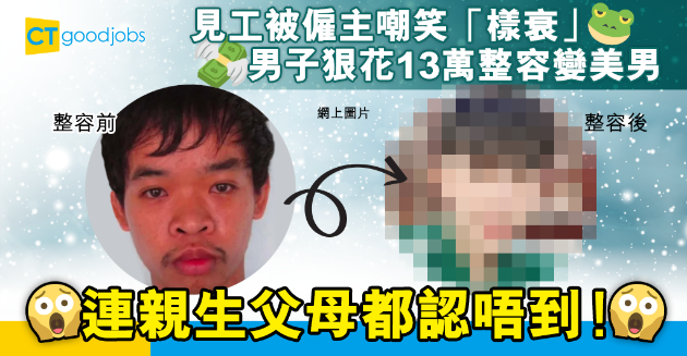 【職場熱話】求職被僱主取笑其貌不揚 26歲男子花13萬整容變美男 